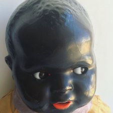 Лечение ножки темнокожего малыша