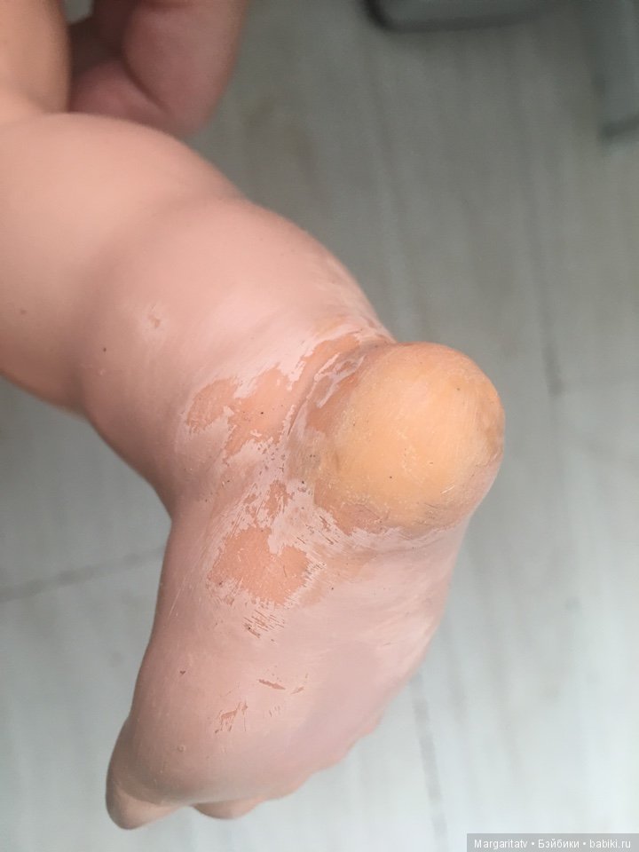 Ремонт тортулонового Любимчика (фото 10)