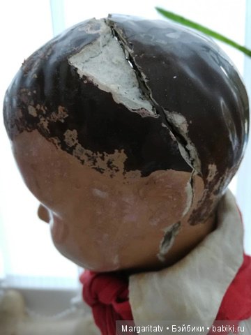 Лечение пионера из 30-х годов (фото 9)