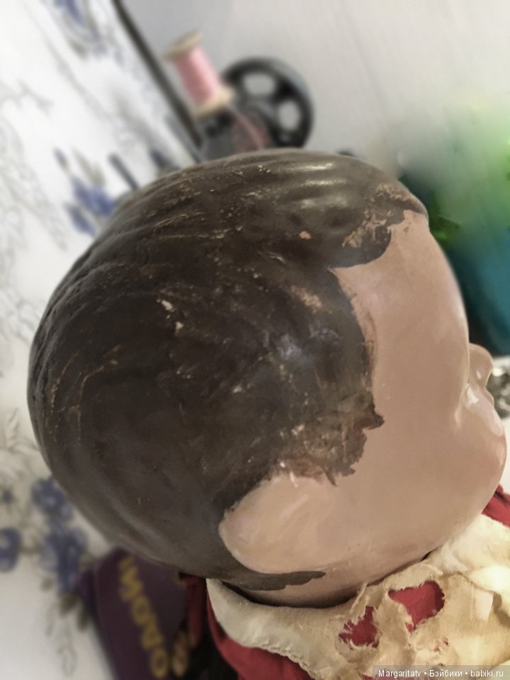 Лечение пионера из 30-х годов