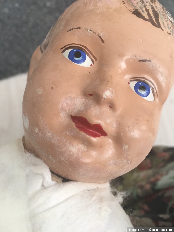 Лечение пионера из 30-х годов (фото 6)