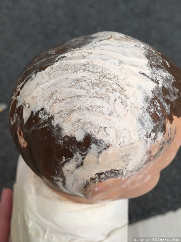 Лечение пионера из 30-х годов