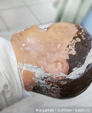 Лечение пионера из 30-х годов (фото 8)