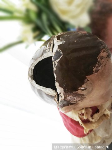 Лечение пионера из 30-х годов (фото 3)