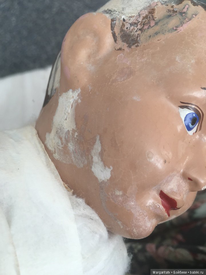 Лечение пионера из 30-х годов (фото 10)