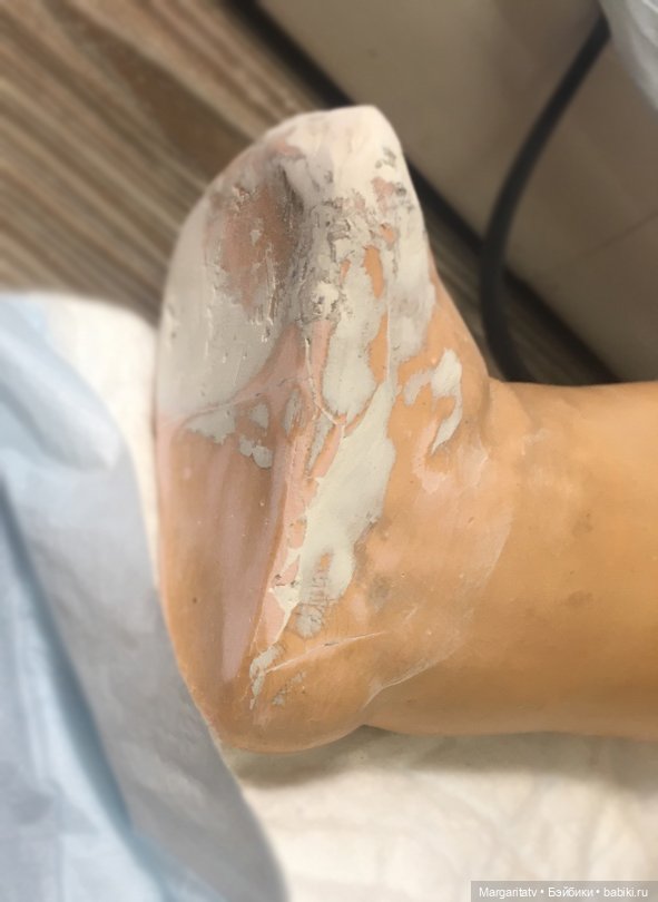 И снова Зонненберг — Реставрация антикварных кукол: ремонт фарфора (фото 7)