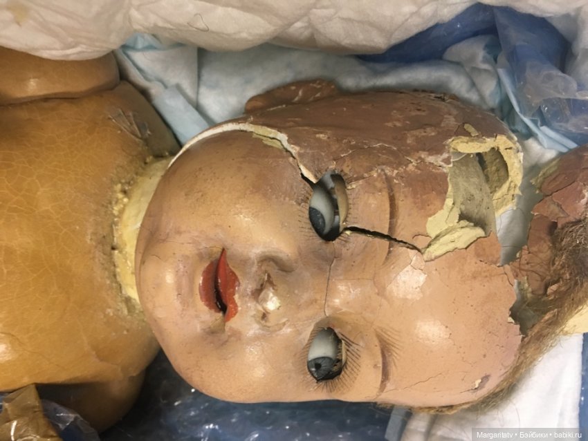 Лечение Агнеты — Всё об антикварных куклах: история (фото 2)