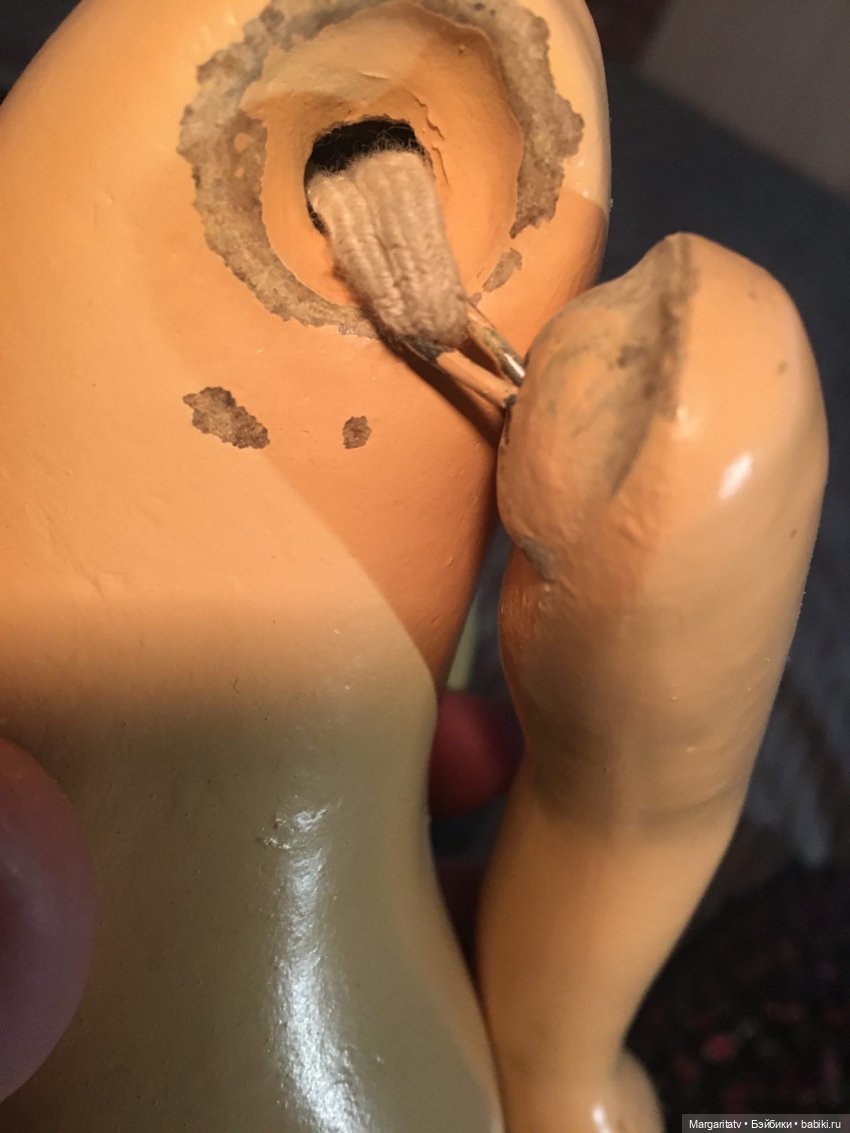 Ивановская грузинка. Лечение и новый костюм (фото 3)