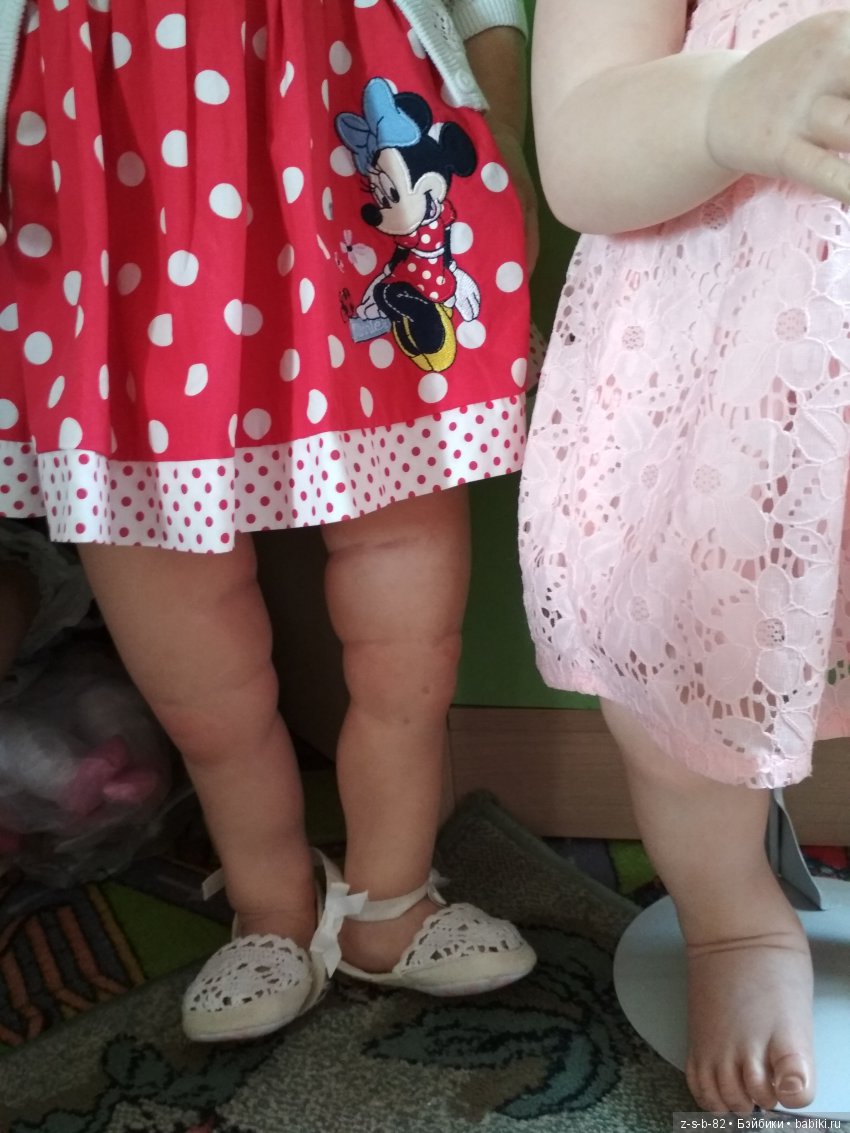 Деформация конечностей у тодлеров. Помогите исправить (фото 2)