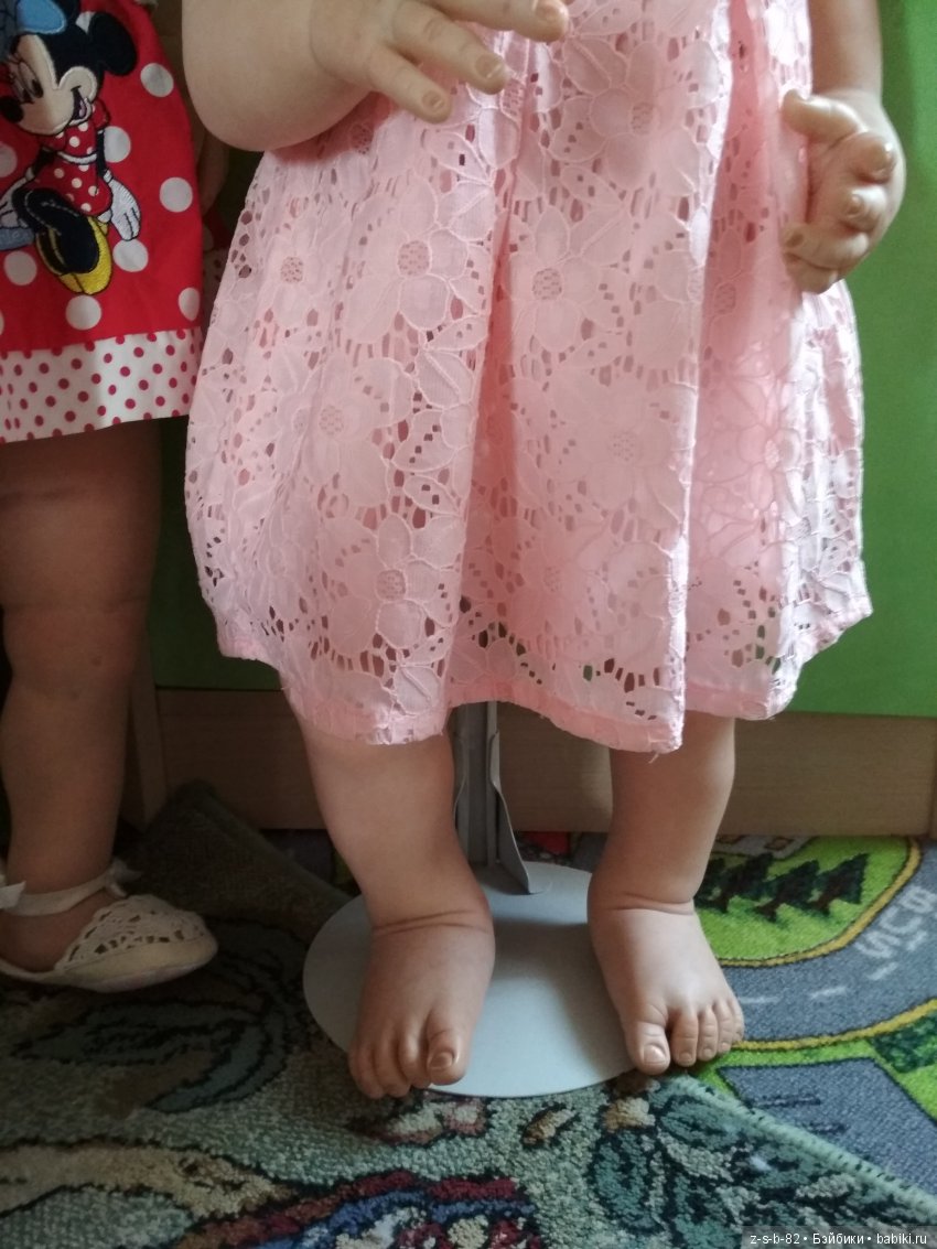 Деформация конечностей у тодлеров. Помогите исправить (фото 3)