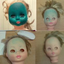 Лечение закончили, но