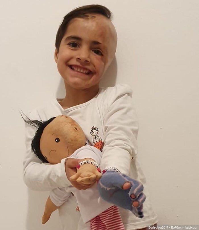 Женщина шьет особенные куклы для детей-инвалидов (фото 9)