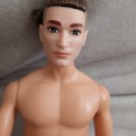 Пучек на теле Стивена Тревога из села Райский остров.