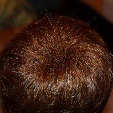 Очень странные волосы у Алистера