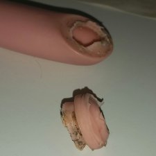 Помогите восстановить ручку