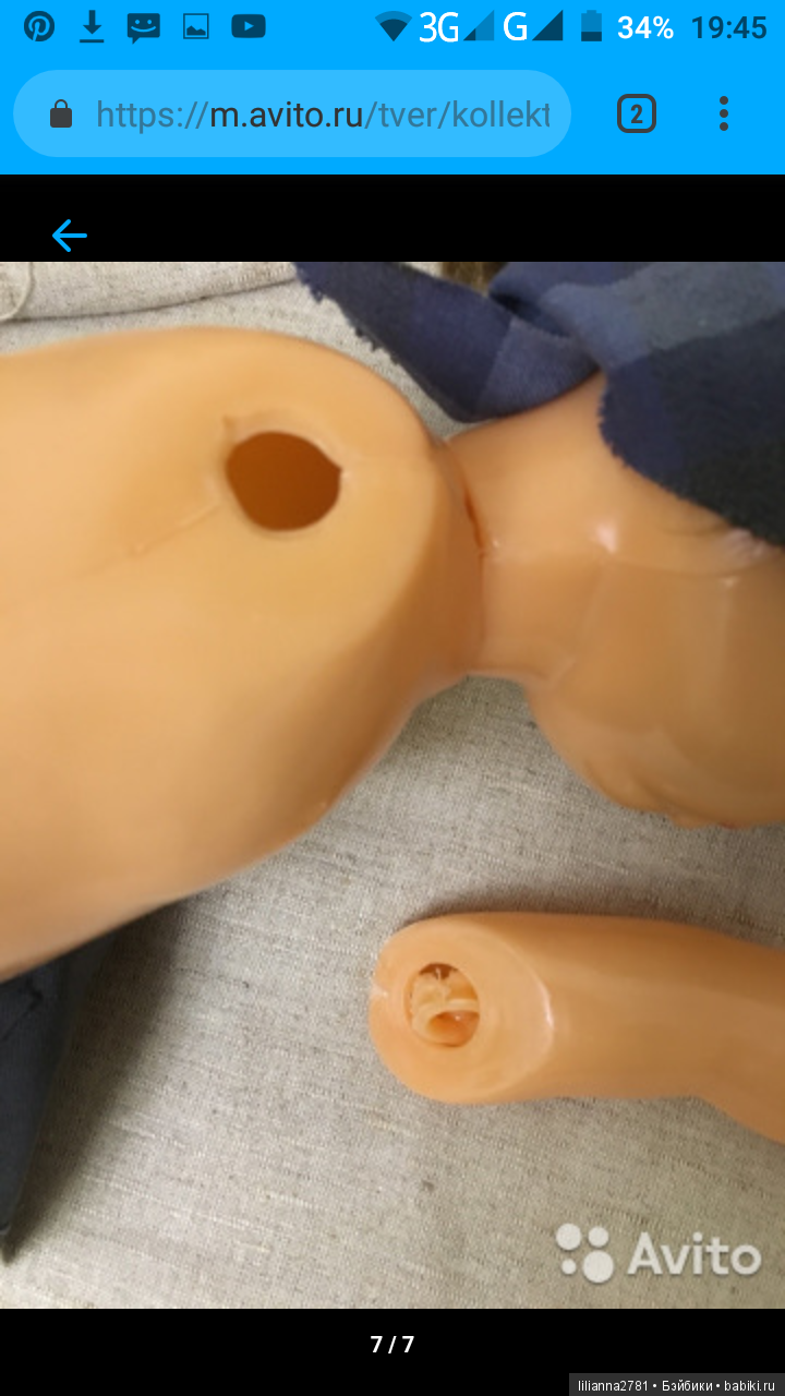 Восстановление крепления руки у Люси (фото 2)