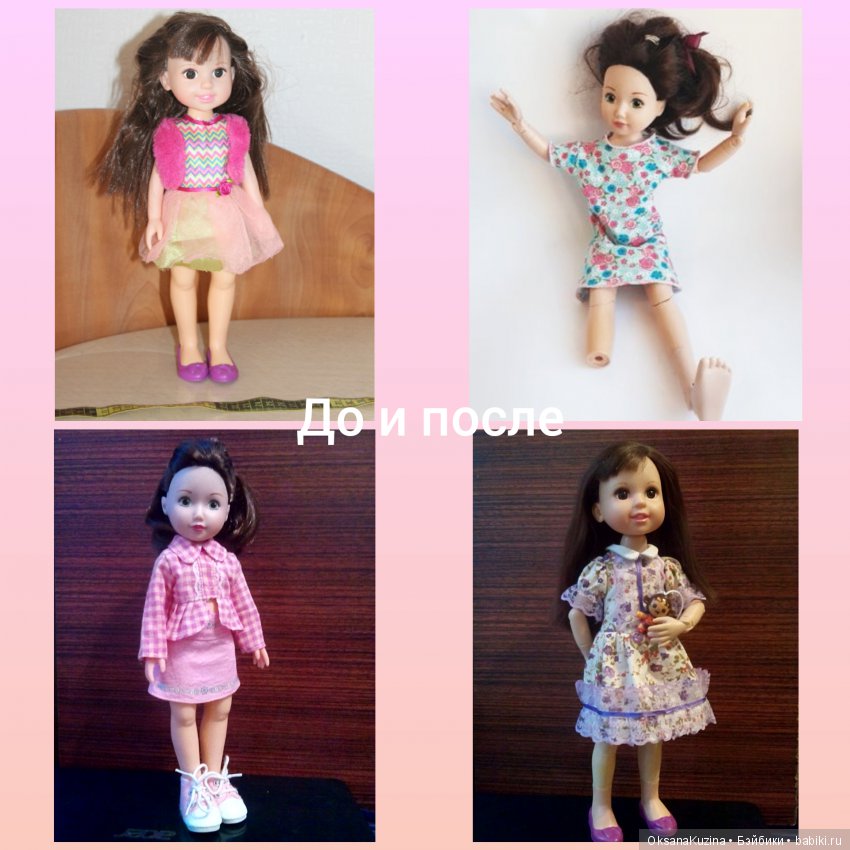 Преображение с трансплантацией (фото 3)