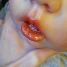 Помощь малышу Лиаму