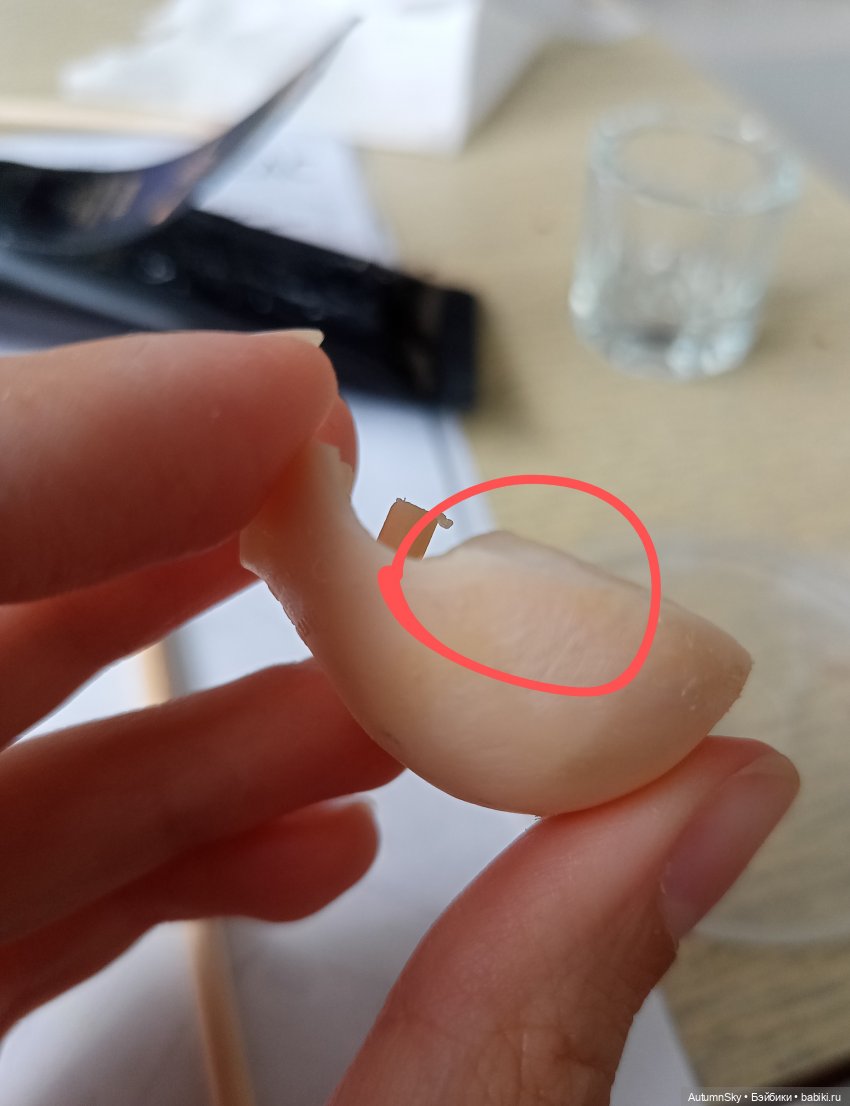 Пересадка J-Doll (технические фото) (фото 9)