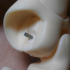 Починка тазобедренного шарнира азонке