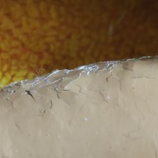 Варикоз из прессопилок