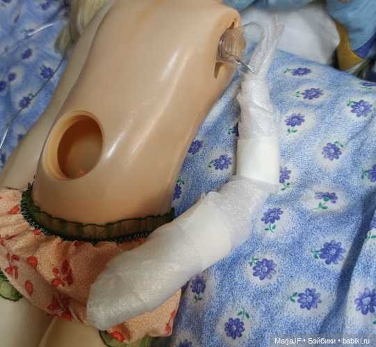 Протез "нечастой" девочке (фото 2)