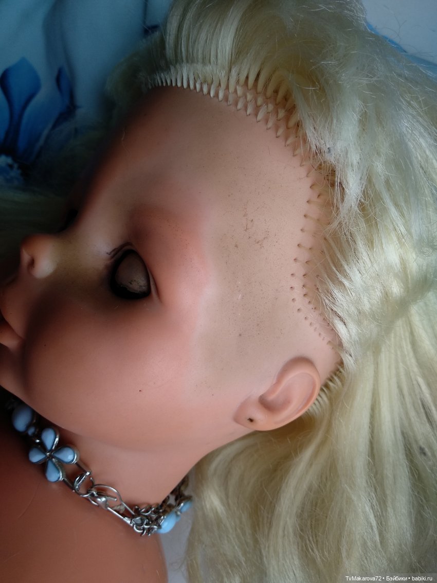 На виске как ожог