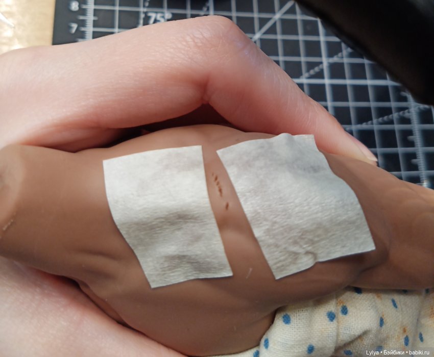 Разрыв на плече уже пальчиками растягиваем и смыкаем