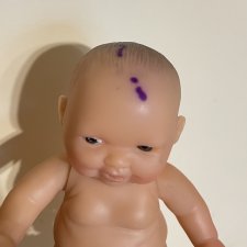 Можно ли вылечить такую проблему