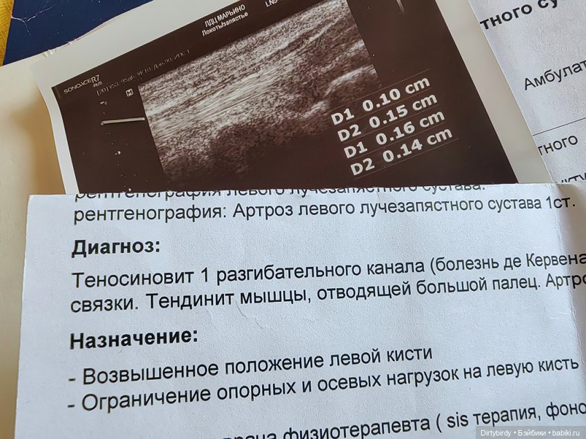 Как снимался детектив Отель смерть & завтрак. Закулисье этого цирка. 2 часть.🍿🎪 (фото 8)