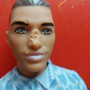 Лечение носа Кену