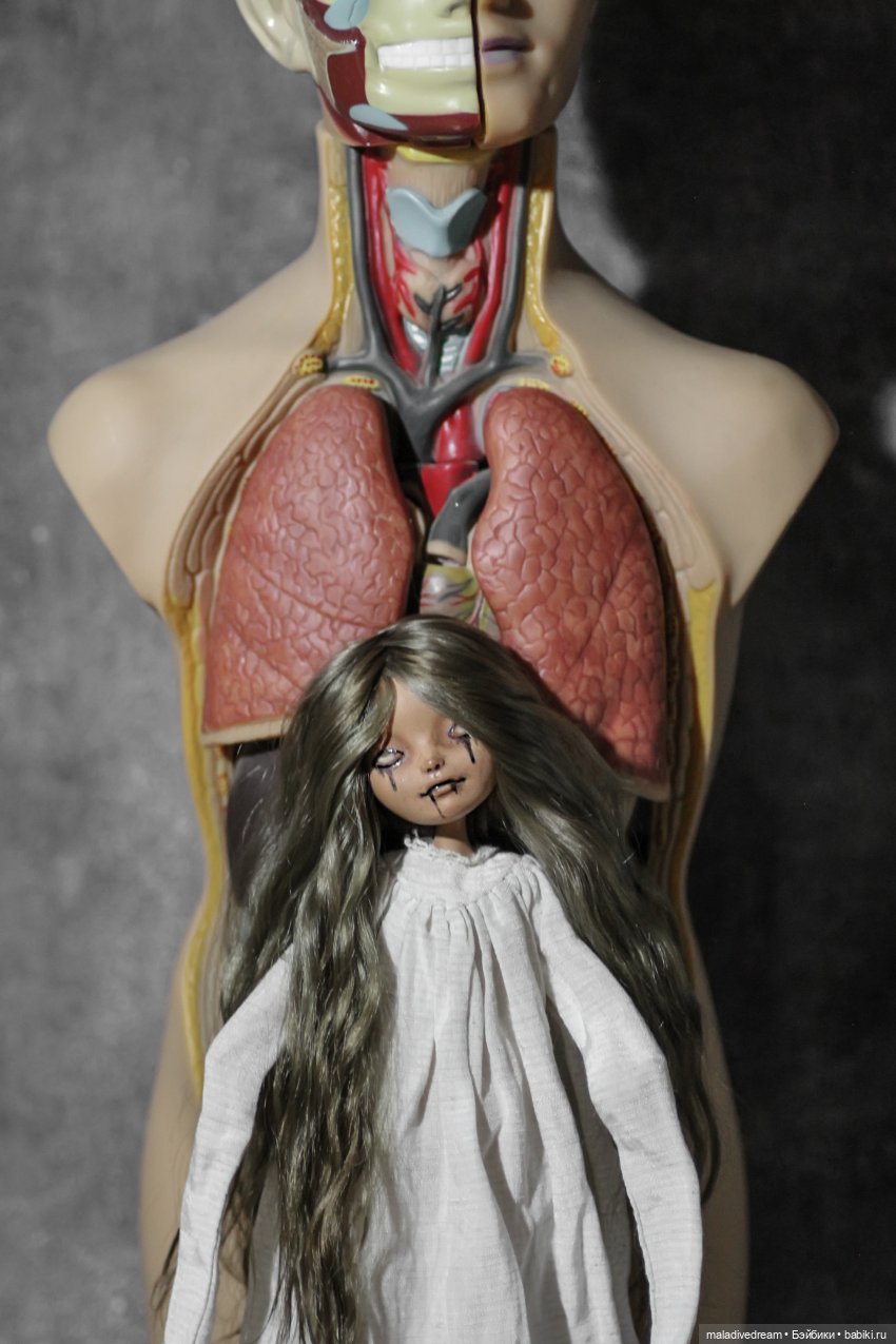 Алиса в Психиатрическом отделении (фото 2)