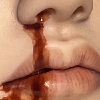 Кровь из носа