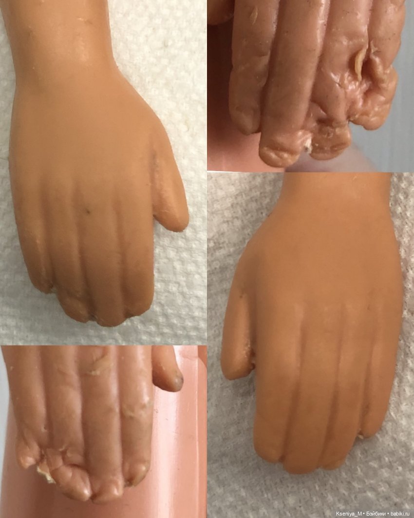 Восстановление убитого кена часть 3! Дарим новые руки