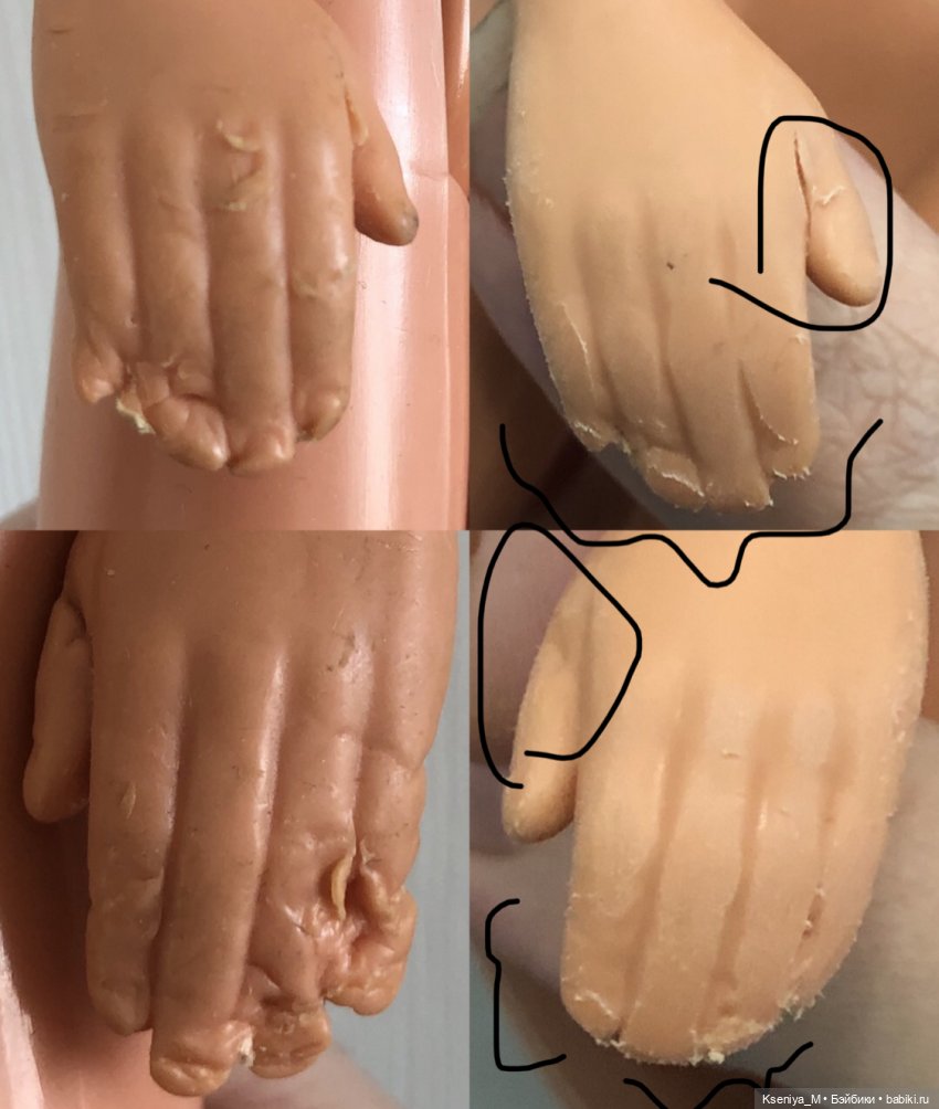 Восстановление убитого кена часть 3! Дарим новые руки