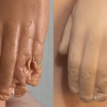 Восстановление убитого кена часть 1. Убираем погрызы на руках