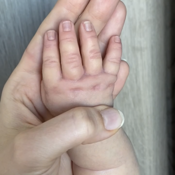 Для чего нужен Thinning medium?