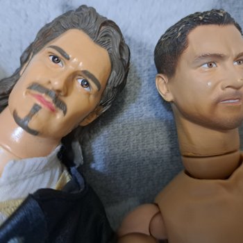 Прошу помощи в пересадке головы или ног