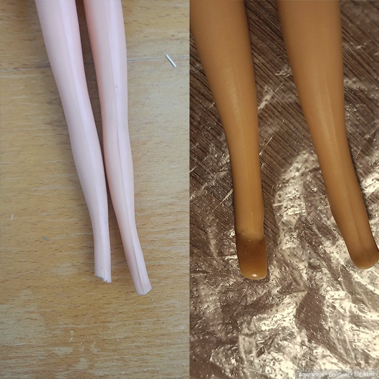 Реставрация тела (восстановление откушенной ступни)