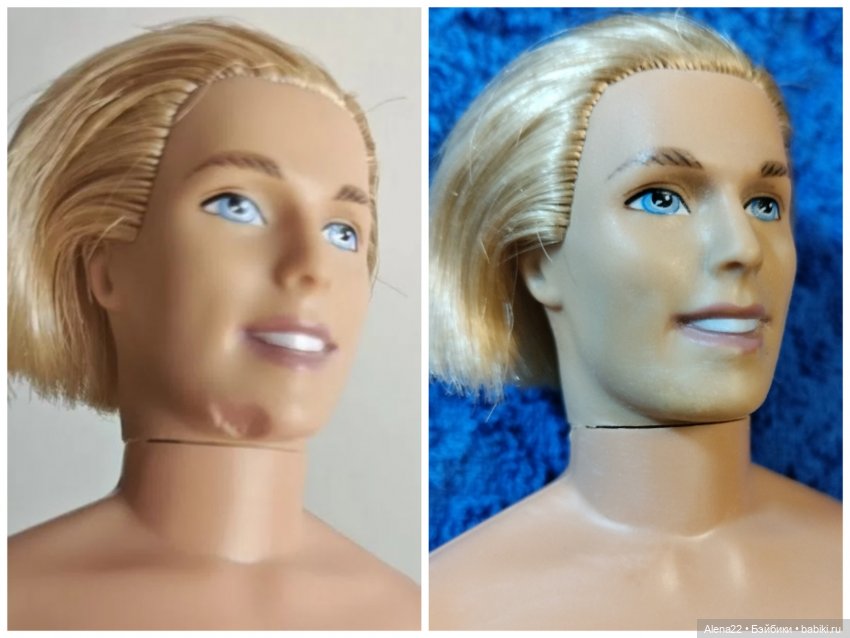 Восстановление лица Кена, Барби