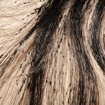 Как легко и быстро вычесать яйца вшей из локонов козы для прошивки кукол.