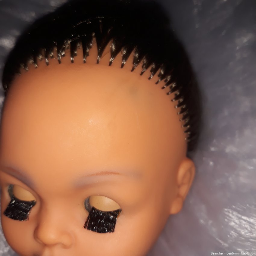 Они обесцветились хуже, чем на шее. Я думаю потому, что изнутри наложить на них диски с оксидантом было сложно - пока удавалось пропихнуть их до пораженного места, диск прилипал ко всему и наверно бОльшая часть оксиданта просто размазалась "по пути".