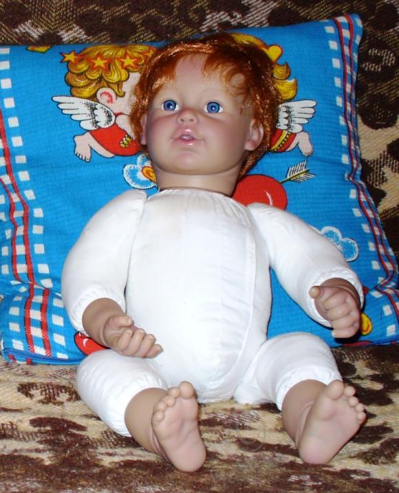 Пластические операции на теле (фото 4)