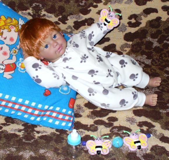 Пластические операции на теле (фото 7)