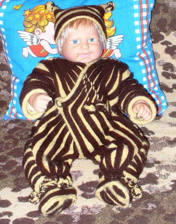 Пластические операции на теле (фото 9)