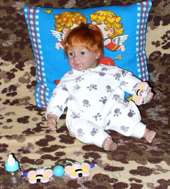 Пластические операции на теле (фото 8)