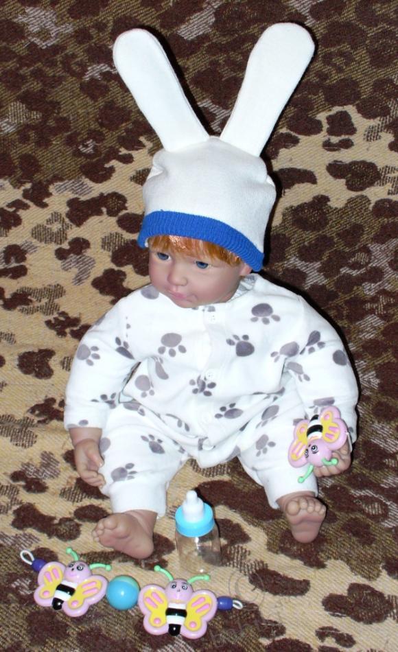 Пластические операции на теле (фото 5)