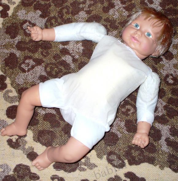 Пластические операции на теле (фото 2)