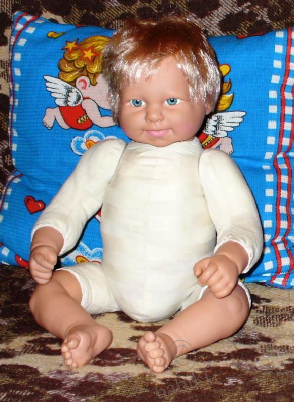 Пластические операции на теле (фото 3)