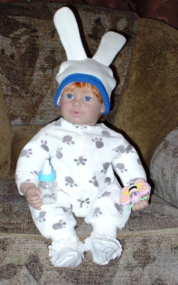 Пластические операции на теле (фото 6)